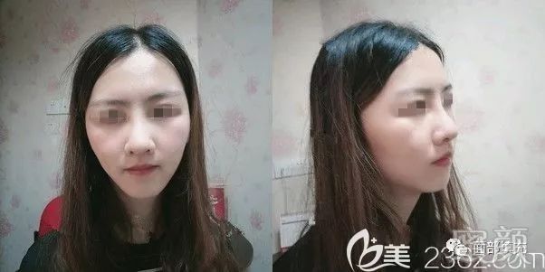 https://img.yiyiaimei.com/mnt/timg/200206/140RGC2-2.jpg