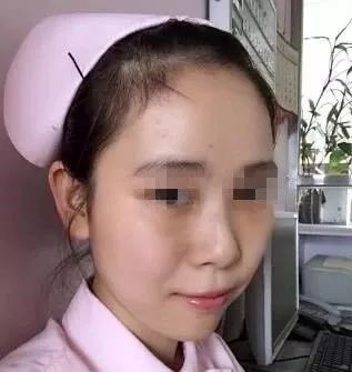 案例图片
