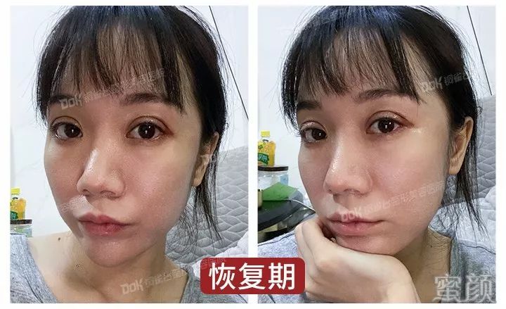 案例图片