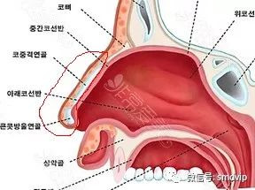 案例图片