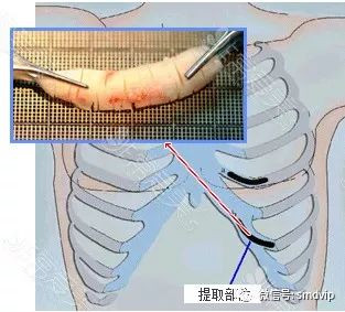 案例图片