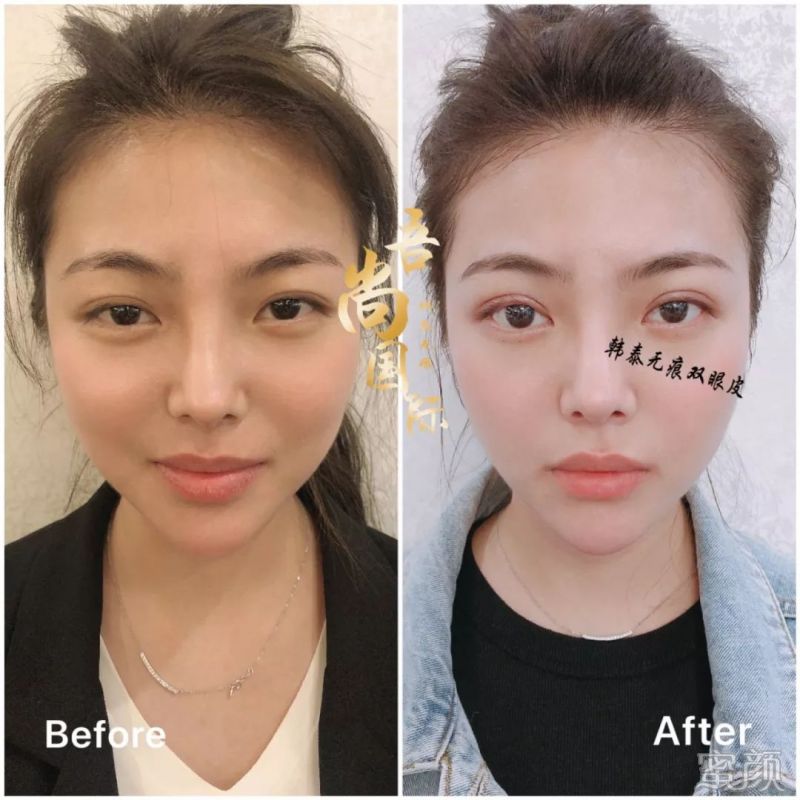 https://img.yiyiaimei.com/mnt/timg/200209/1249201551-2.jpg