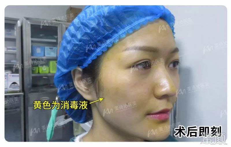 案例图片