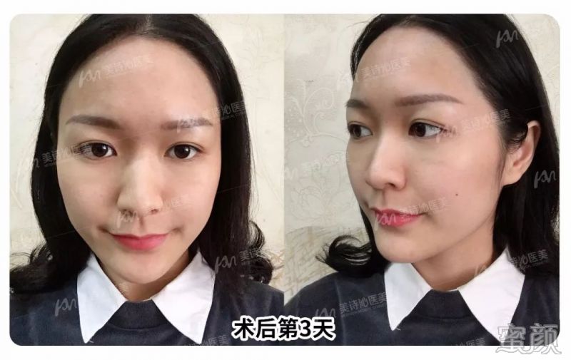 案例图片