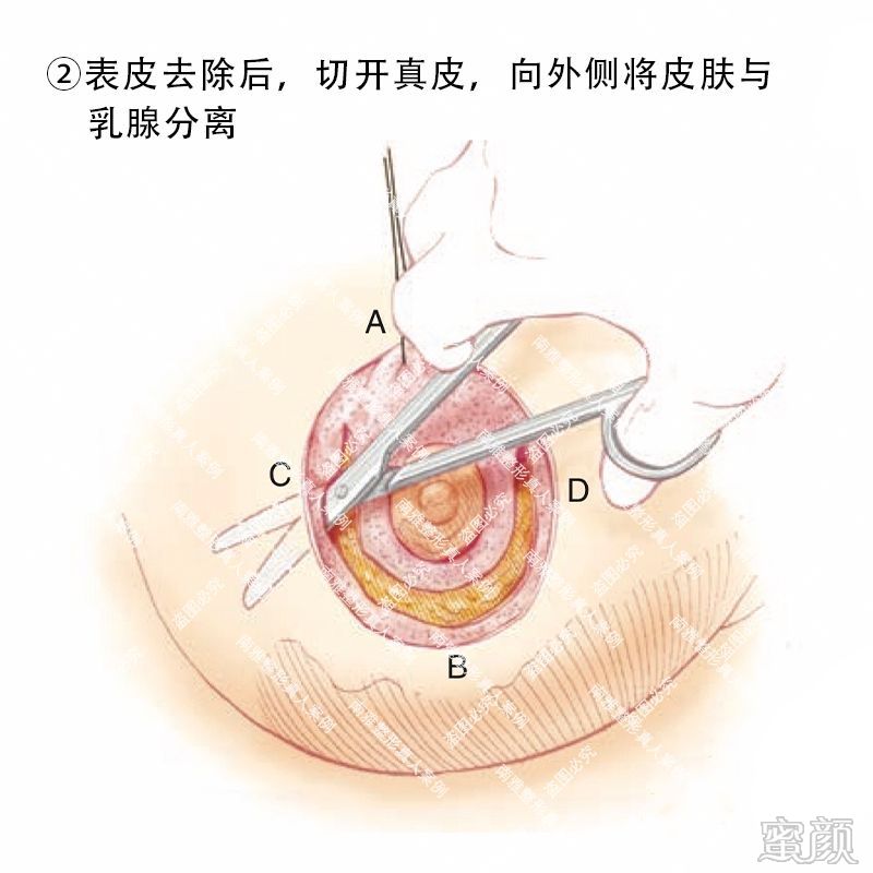 案例图片