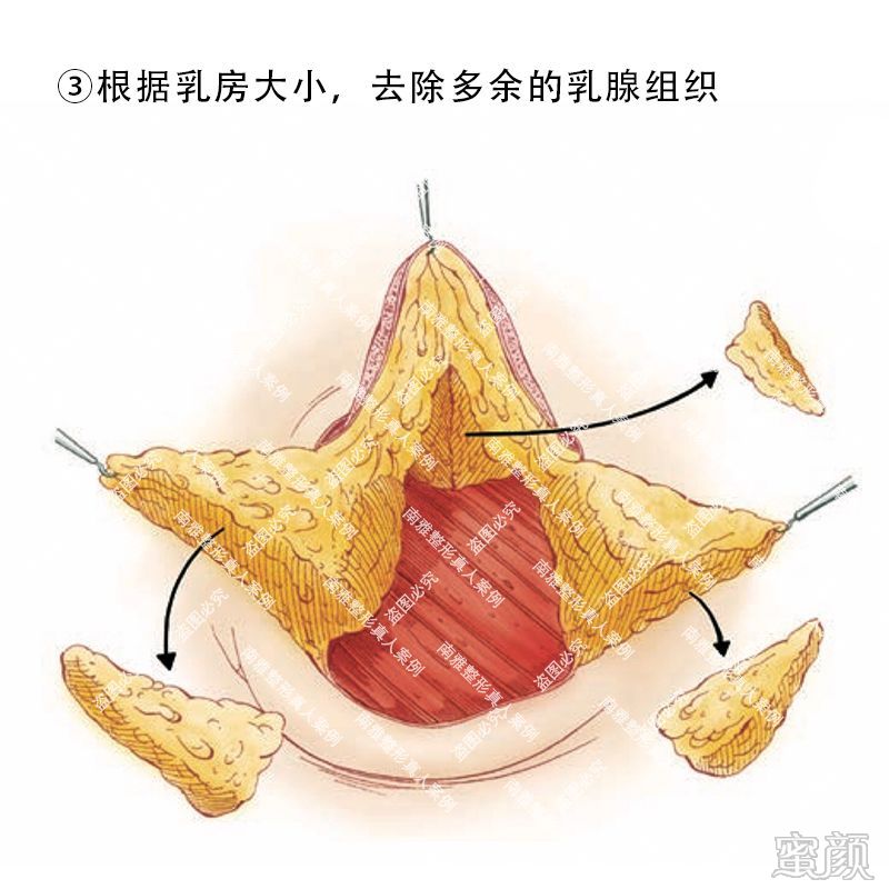 案例图片