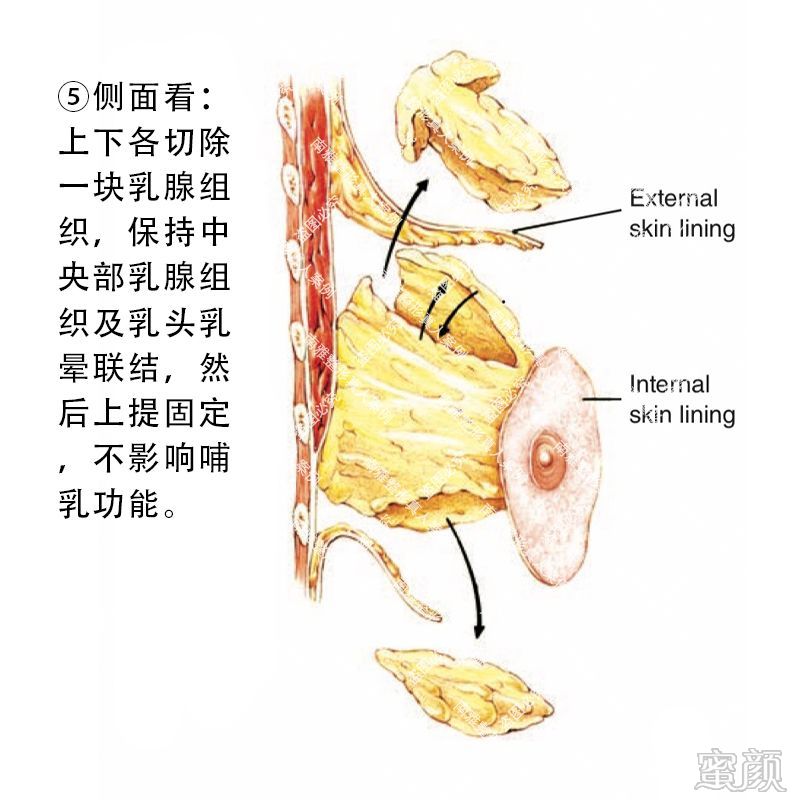 案例图片