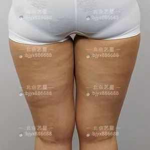 https://img.yiyiaimei.com/mnt/timg/200210/13110T1X-5.jpg