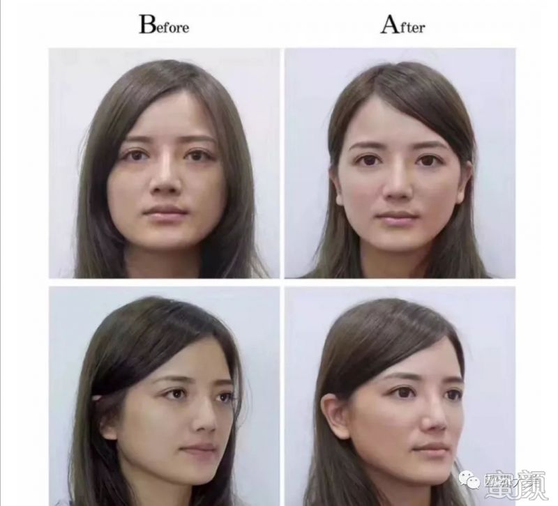 案例图片