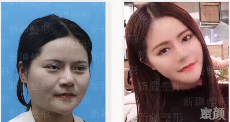 https://img.yiyiaimei.com/mnt/timg/200210/135FS649-2.jpg 案例图片