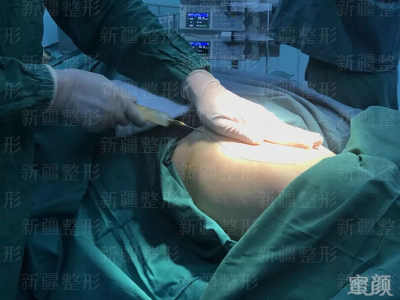 https://img.yiyiaimei.com/mnt/timg/200210/135G21240-8.jpg 案例图片