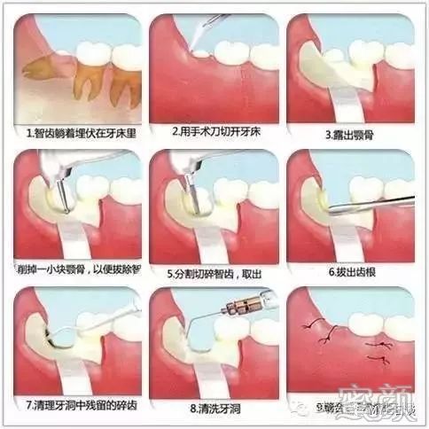 案例图片