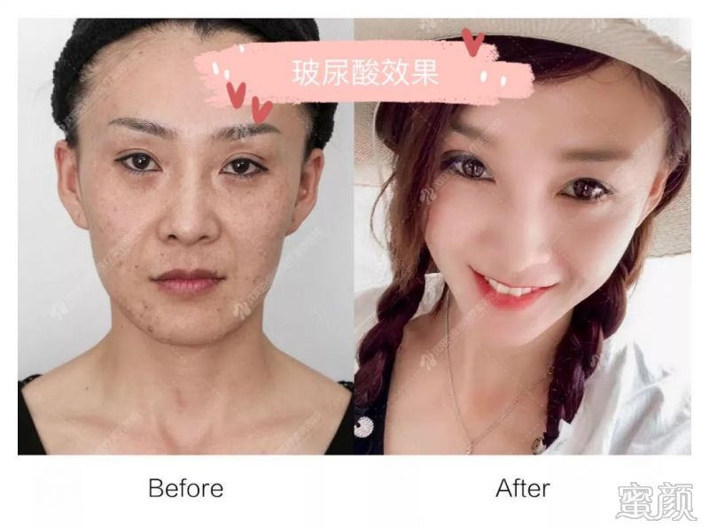 https://img.yiyiaimei.com/mnt/timg/200211/1400136063-5.jpg