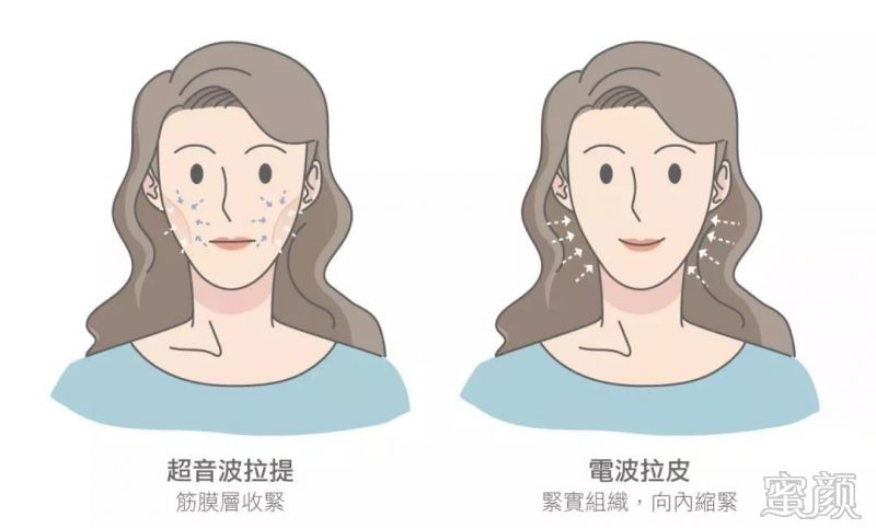 https://img.yiyiaimei.com/mnt/timg/200211/140423A61-3.jpg