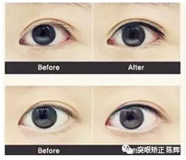 https://img.yiyiaimei.com/mnt/timg/200211/142K02X2-6.jpg