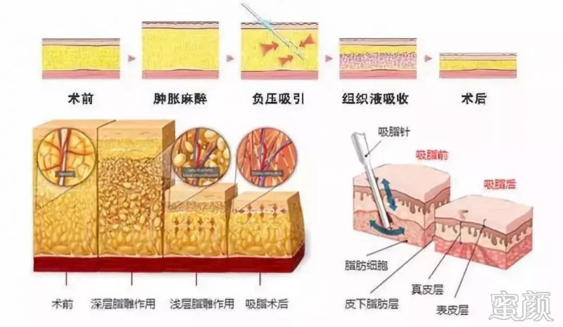 案例图片