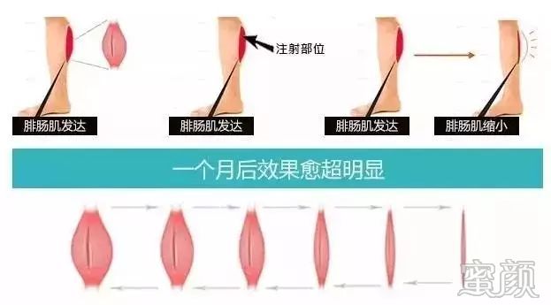 案例图片