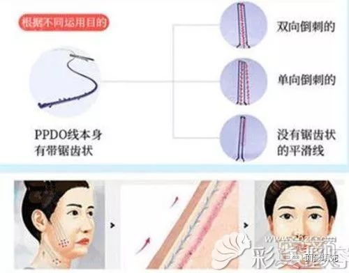 案例图片