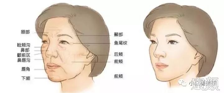 https://img.yiyiaimei.com/mnt/timg/200212/141UB138-0.jpg
