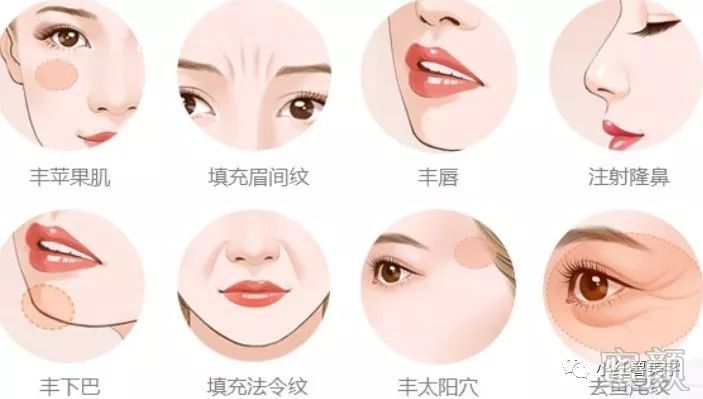 https://img.yiyiaimei.com/mnt/timg/200212/141UMK7-2.jpg