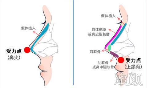 案例图片