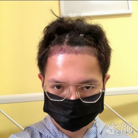 案例图片