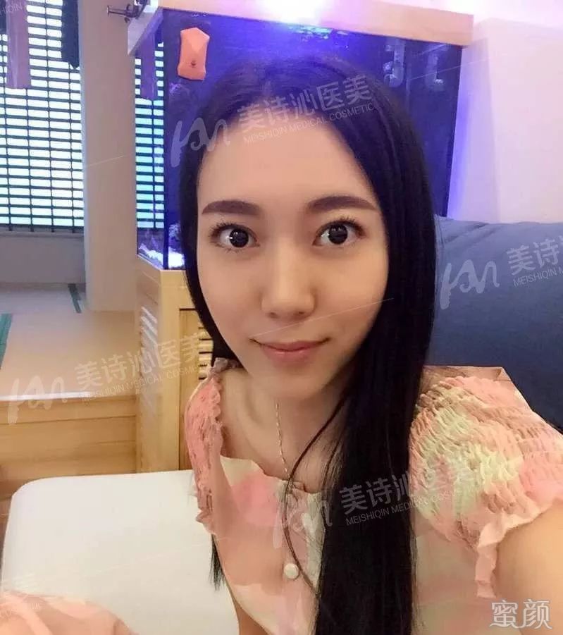 案例图片