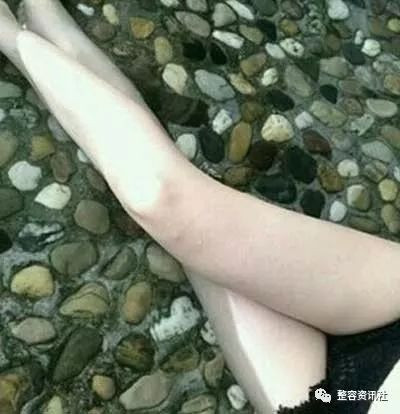 案例图片