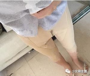 案例图片