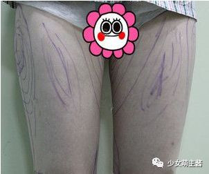 案例图片