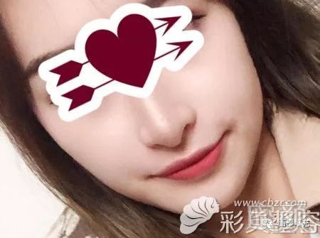 https://img.yiyiaimei.com/mnt/timg/200214/12515C0N-2.jpg