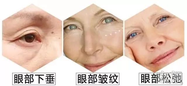 案例图片