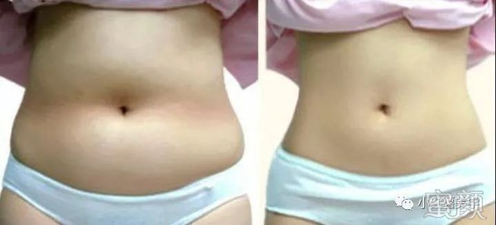 https://img.yiyiaimei.com/mnt/timg/200214/14011015V-0.jpg