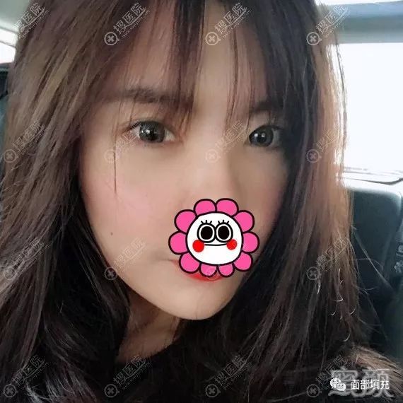 https://img.yiyiaimei.com/mnt/timg/200214/1402492F8-2.jpg