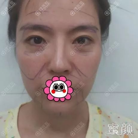 https://img.yiyiaimei.com/mnt/timg/200214/14024QI6-0.jpg