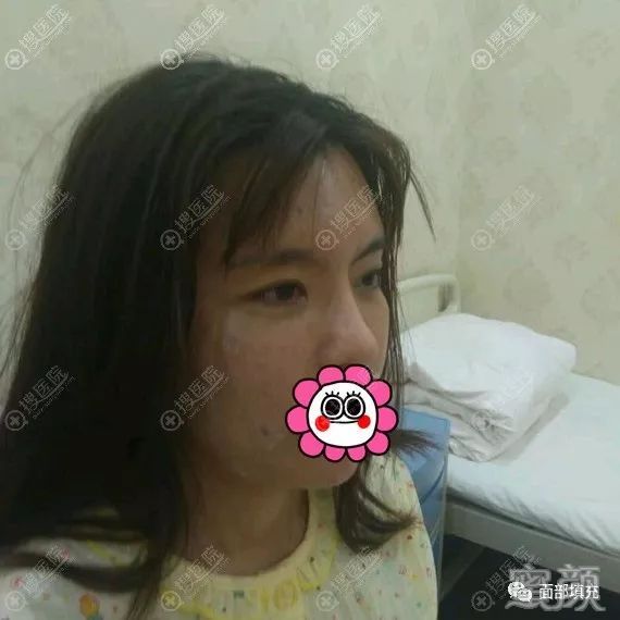 https://img.yiyiaimei.com/mnt/timg/200214/14024S3L-1.jpg