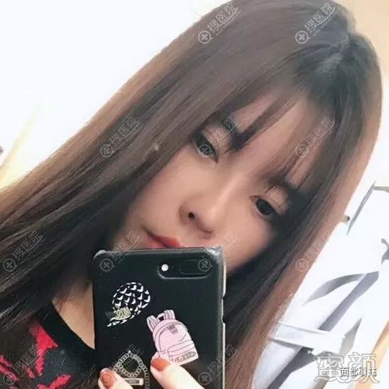 https://img.yiyiaimei.com/mnt/timg/200214/14025025B-3.jpg