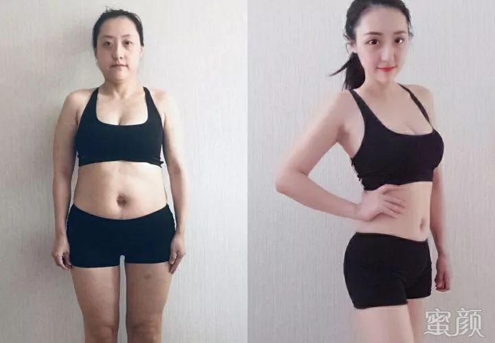 https://img.yiyiaimei.com/mnt/timg/200214/1404144125-0.jpg 案例图片