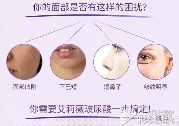 案例图片