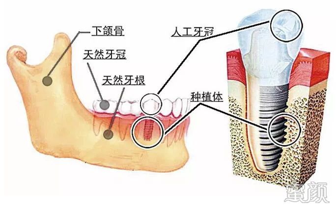 https://img.yiyiaimei.com/mnt/timg/200214/1420052138-2.jpg