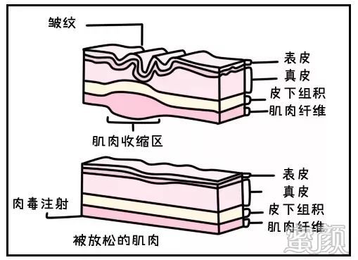 案例图片