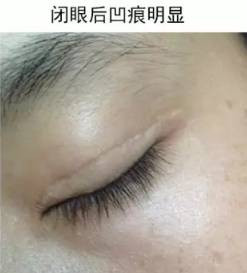 案例图片