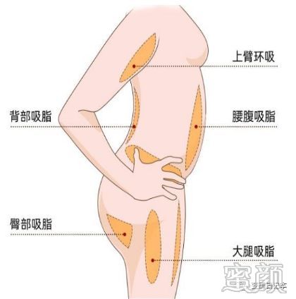 https://img.yiyiaimei.com/mnt/timg/200215/14100J130-9.jpg 案例图片