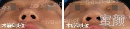 https://img.yiyiaimei.com/mnt/timg/200215/14133622C-3.jpg