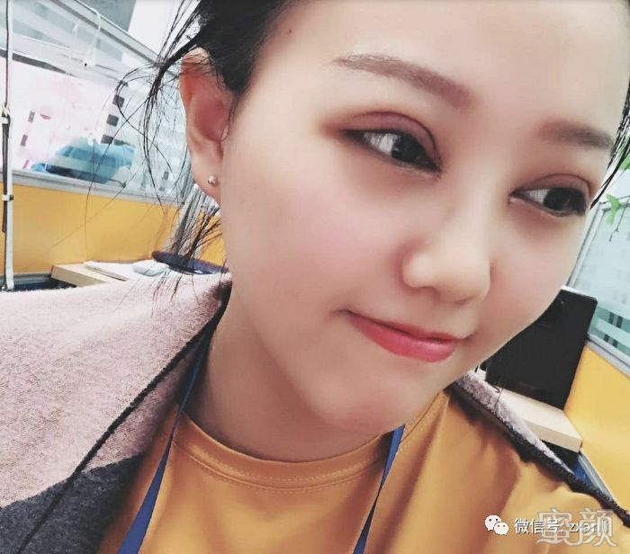 案例图片