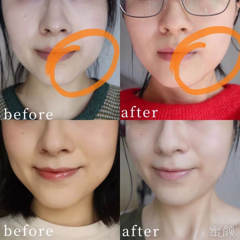 案例图片