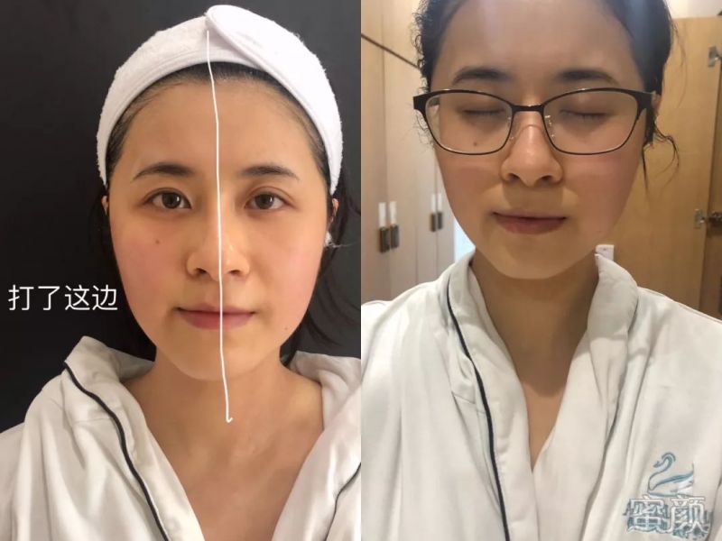 案例图片