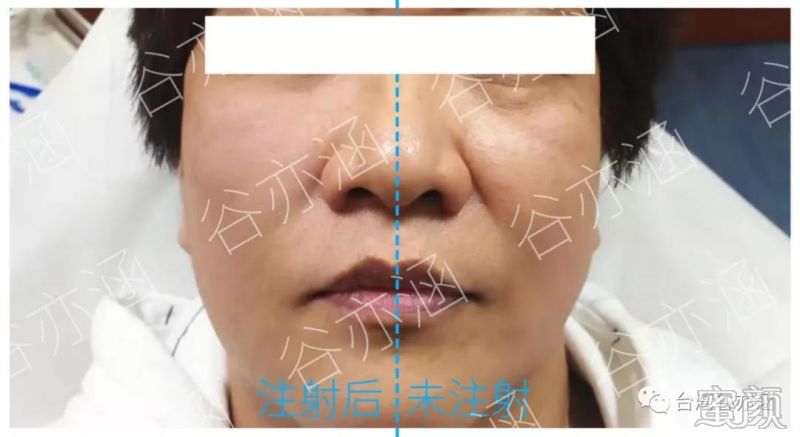 案例图片