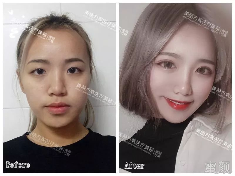 https://img.yiyiaimei.com/mnt/timg/200217/122J05452-2.jpg
