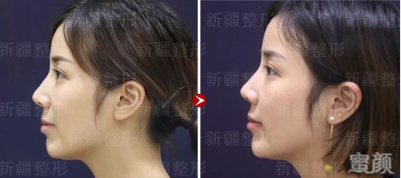 https://img.yiyiaimei.com/mnt/timg/200218/12062521V-2.jpg